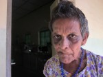 A few old men and women have been living at the Hendala Leprosy Hospital in Sri Lanka for most of their lives